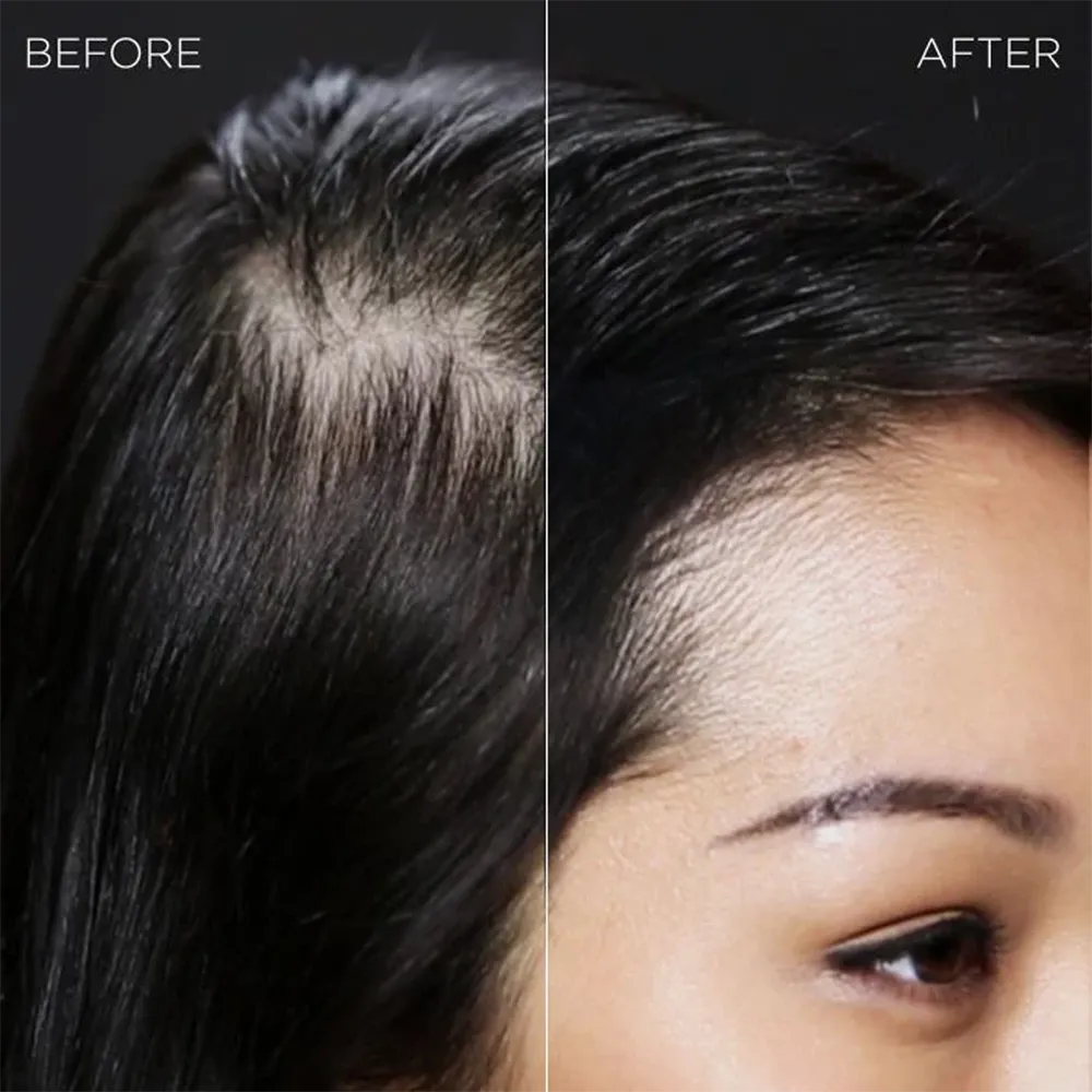 Toppik Hair Building Fibers - Dark Brown thumbnail 3