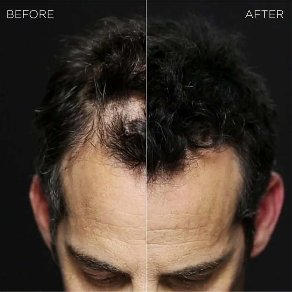 Toppik Hair Building Fibers - Dark Brown thumbnail 4