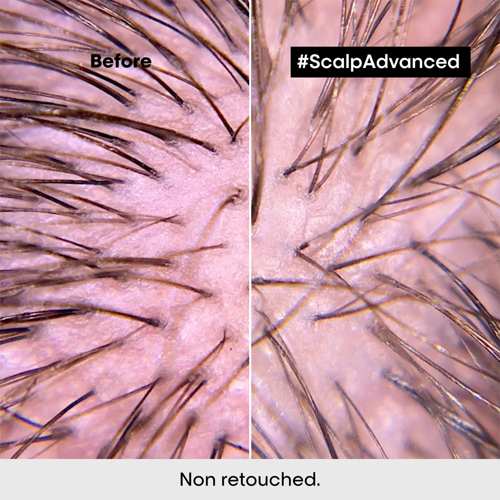 L’Oréal Professionnel Scalp Advanced Anti-Discomfort Intense Soother - 200 ml thumbnail 4