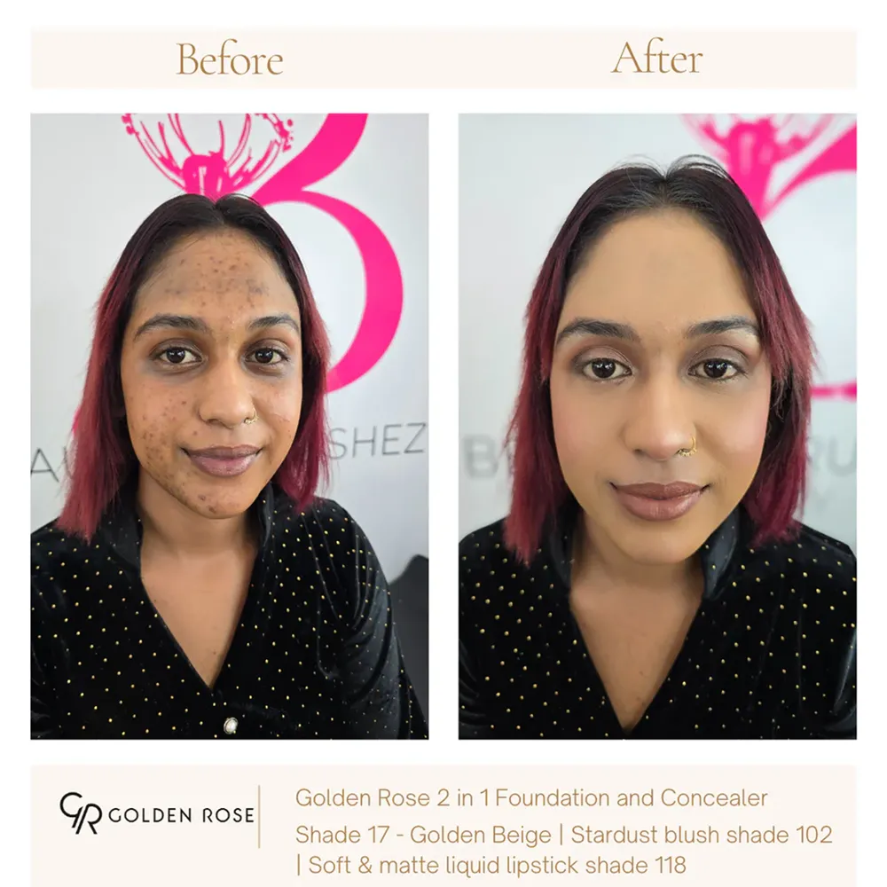 Golden Rose Total Cover 2 in 1 Foundation & Concealer SPF 15 - 17 Golden Beige (30 ml) thumbnail 2