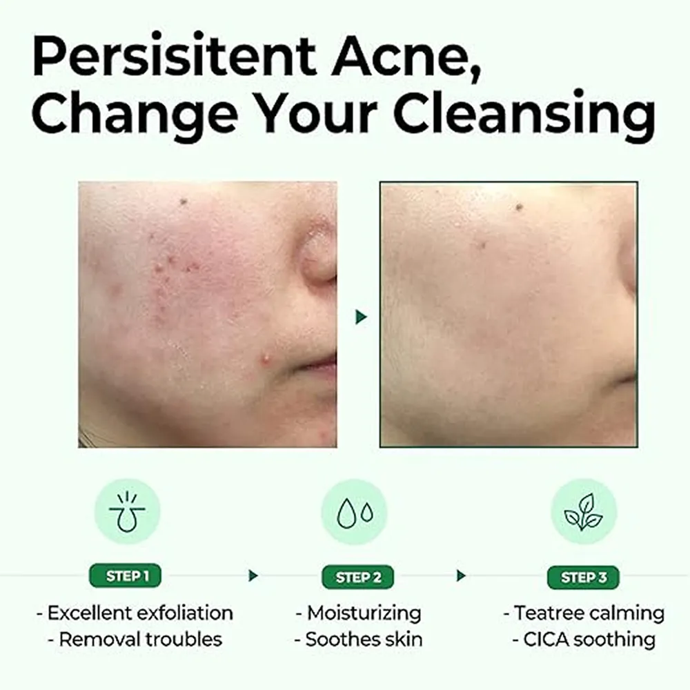 Some By MI AHA-BHA-PHA 30 Days Miracle Cleansing Bar - 106 g thumbnail 6