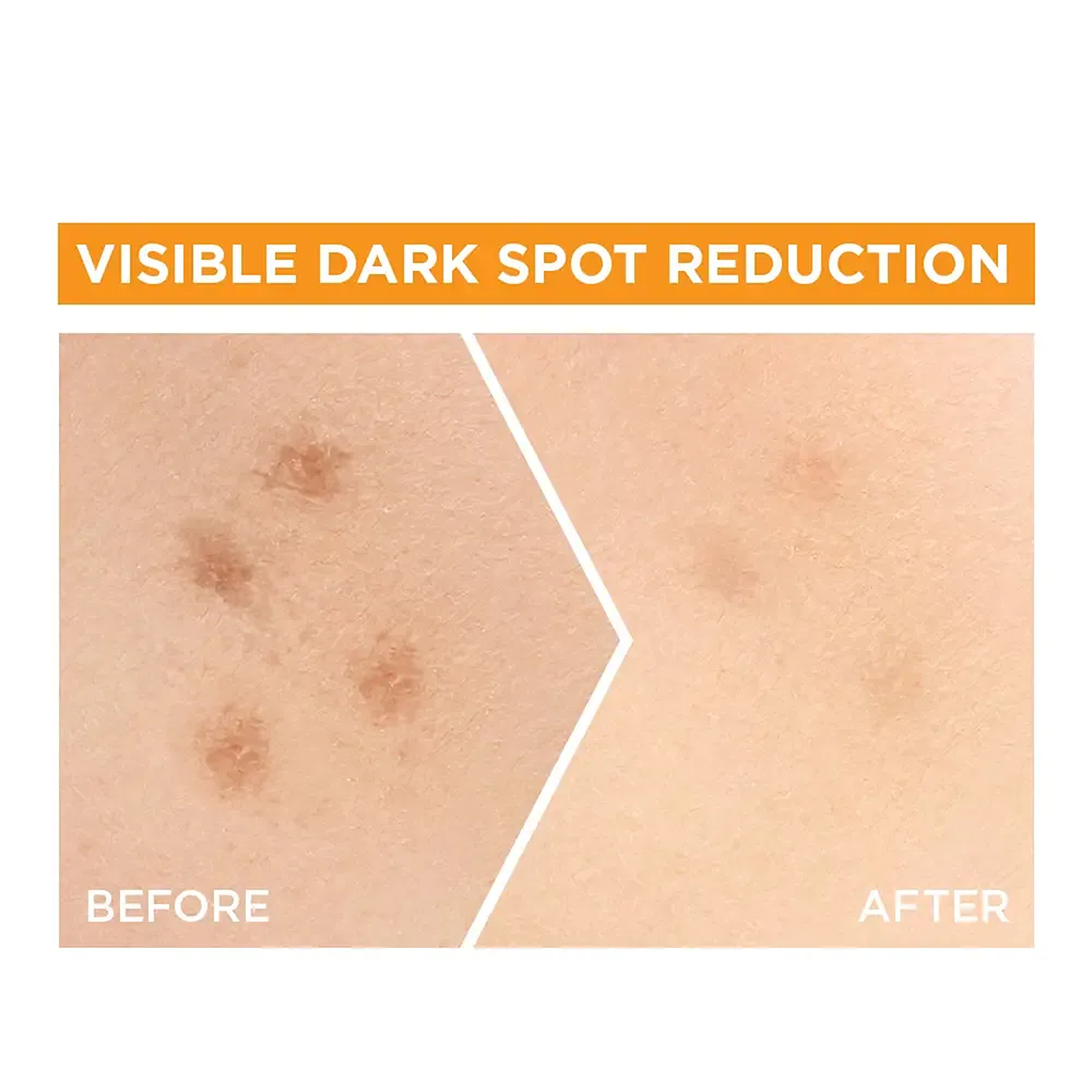 Garnier Fast Bright Serum - 15 ml thumbnail 5