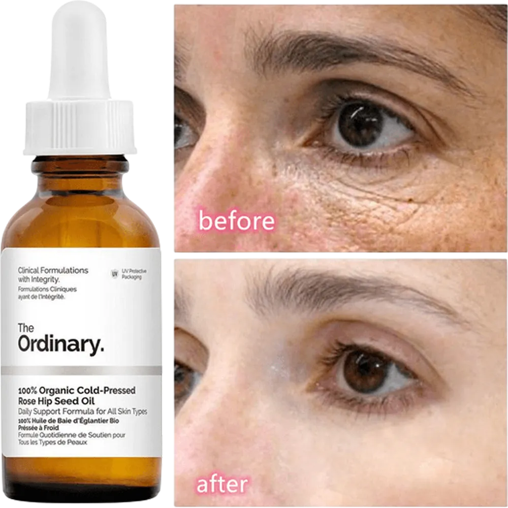 The Ordinary Caffeine Solution 5% + EGCG Eye Serum - 30ml thumbnail 3