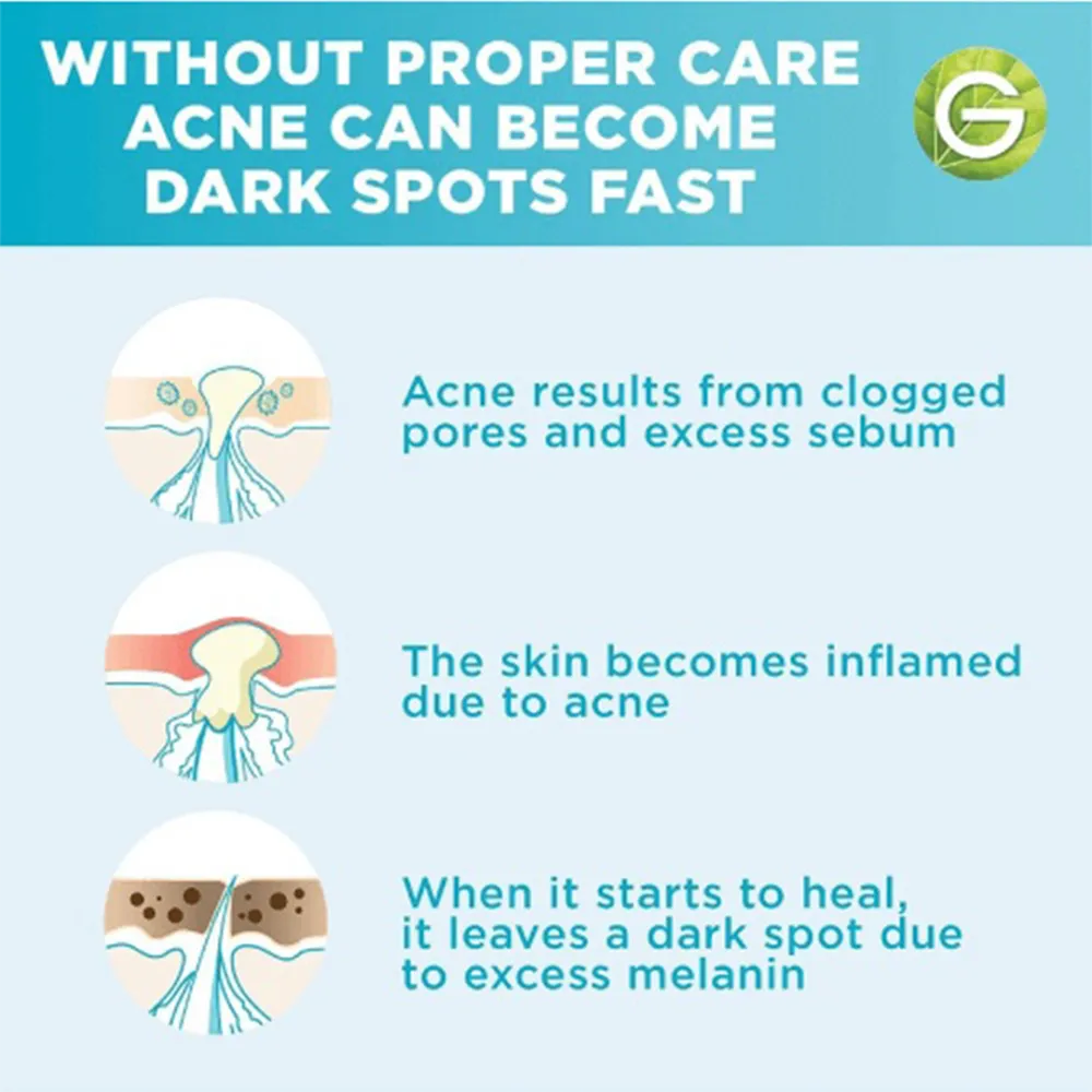 Garnier Skinactive Fast Clear Booster Serum with Salicylic Acid - 15 ml thumbnail 4