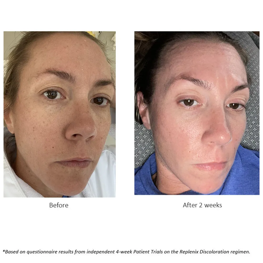 Replenix Glycolic Acid Resurfacing Cleanser - 200 ml thumbnail 3
