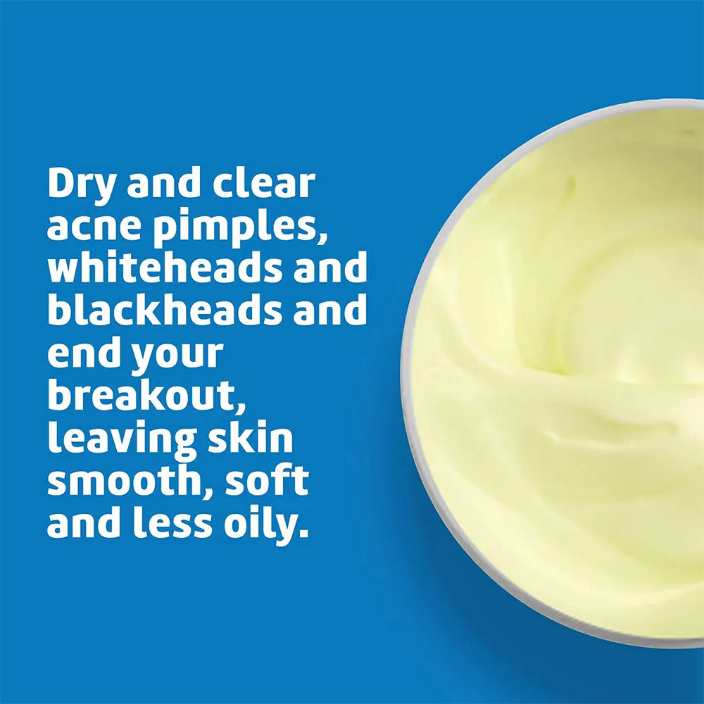 De La Cruz Acne Treatment Ointment with 10% Sulfur Maximum Strength - 73.7 g thumbnail 6